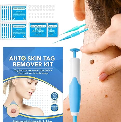 Skin Tag Remover Kit – 2-in-1 Fast & Painless Solution